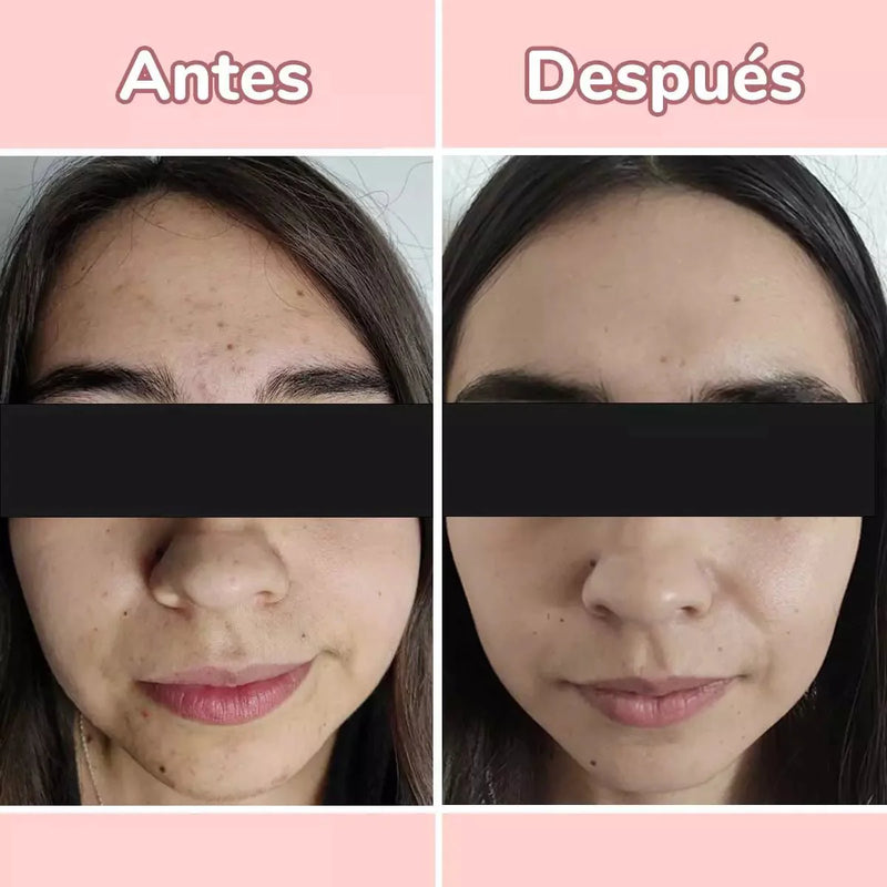 Serum 4 en 1 Antiarrugas y Manchas Para